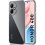 Schutzhülle für Honor 400 Hülle Transparent Slim Cover Clear Case
